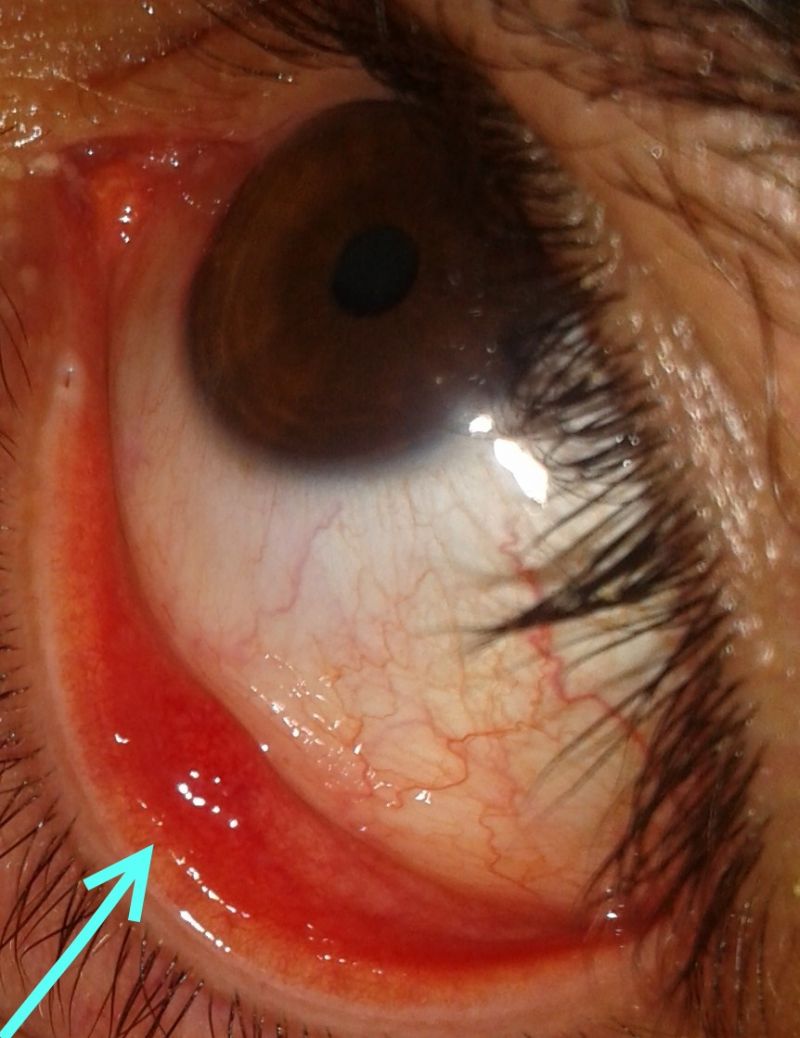 Schema metrico voi ch'ascoltate in rime sparse il suono
