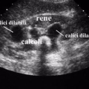 Foto di Malattie del rene