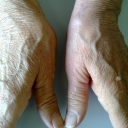 Foto di dott. Riccardo Busa (Chirurgia della Mano e Microchirurgia)