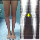 Foto di dott. Perrone (Ortopedia e Traumatologia)