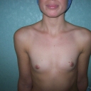 Mastoplastica additiva