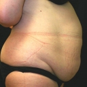 Interventi di Chirurgia Plastica ed Estetica